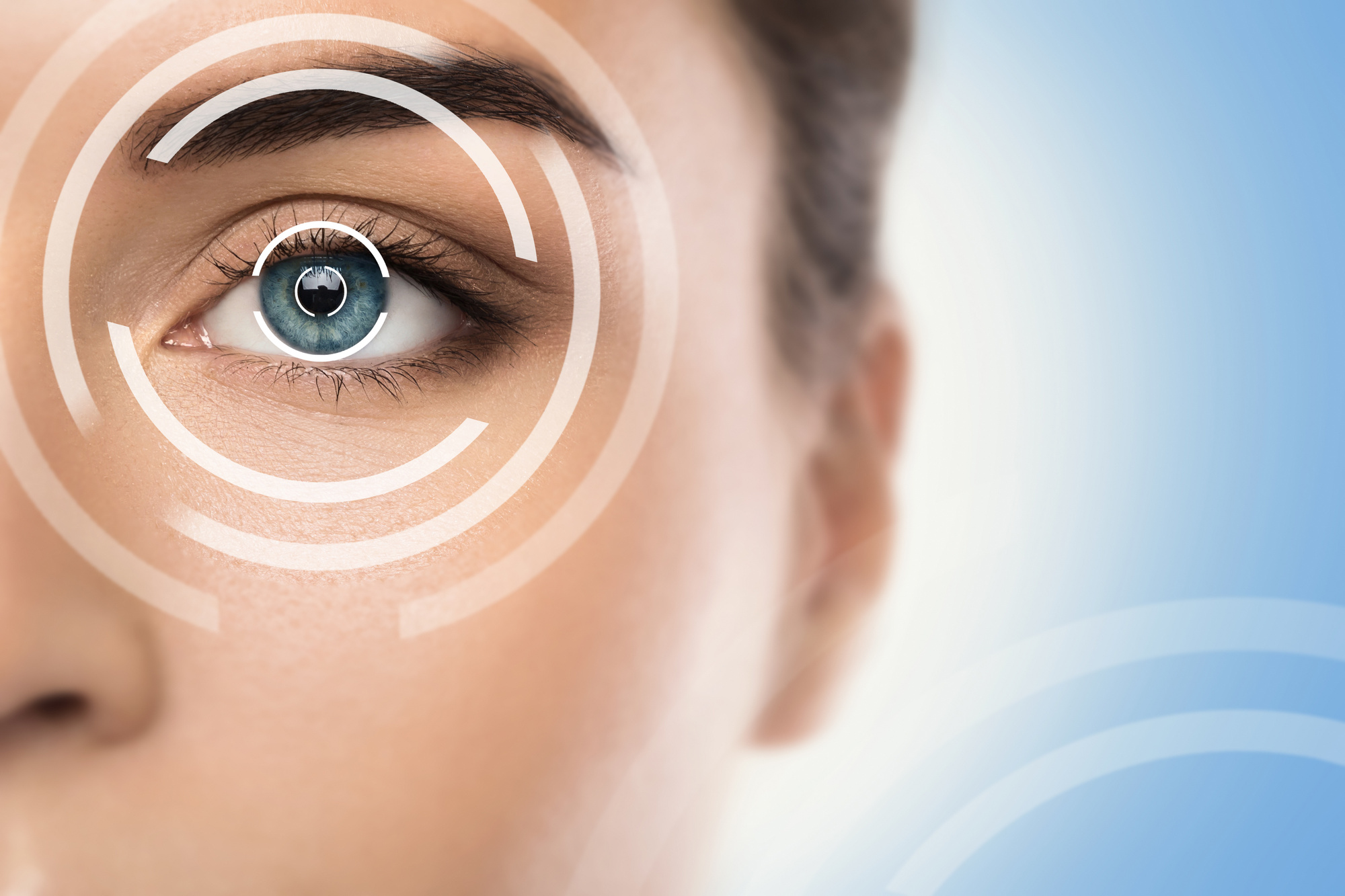 Close-up of Female Eye and Concepts of Laser Eye Surgery.