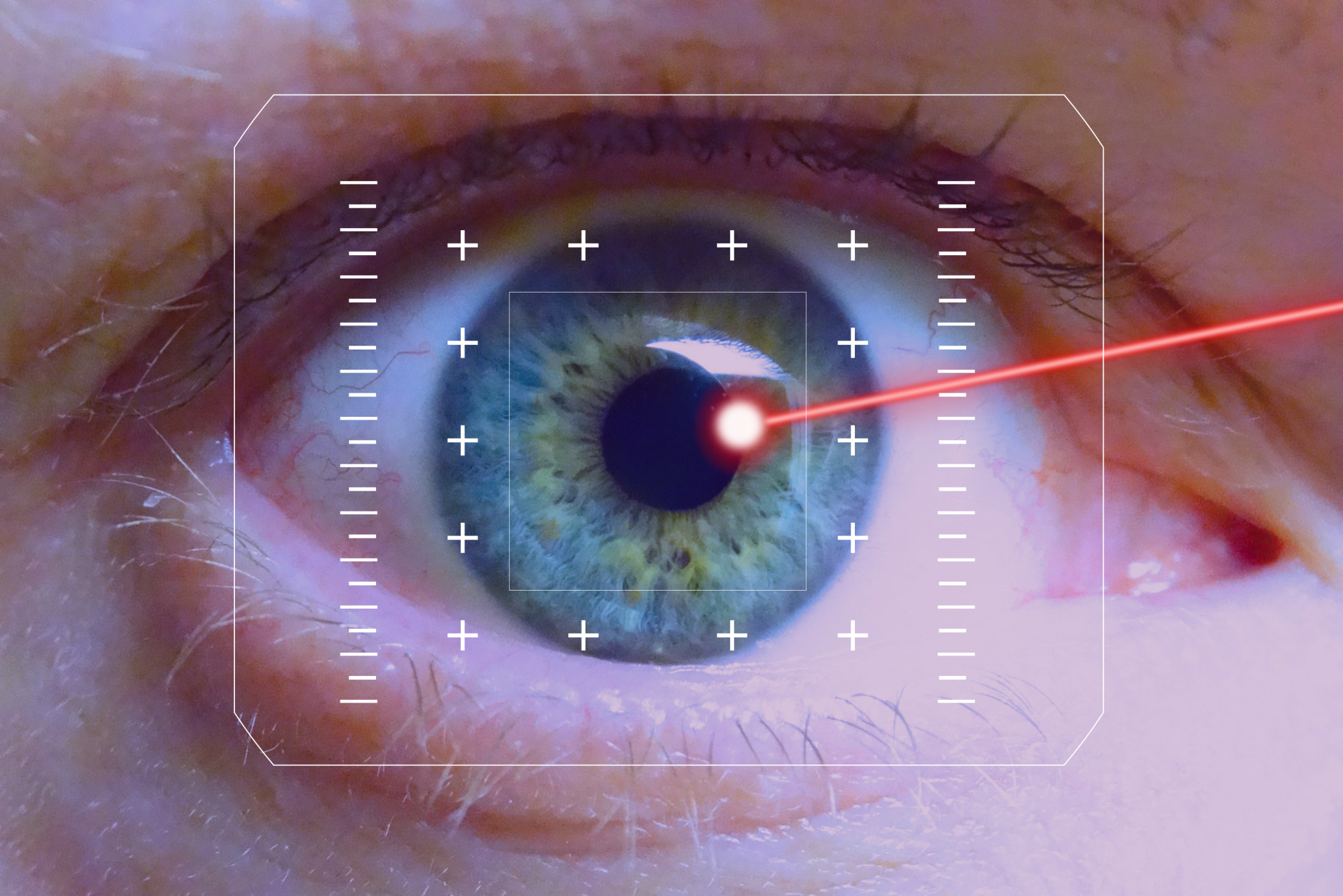 Close up Eye on Laser Eye Surgery in Eye LASIK Austin.