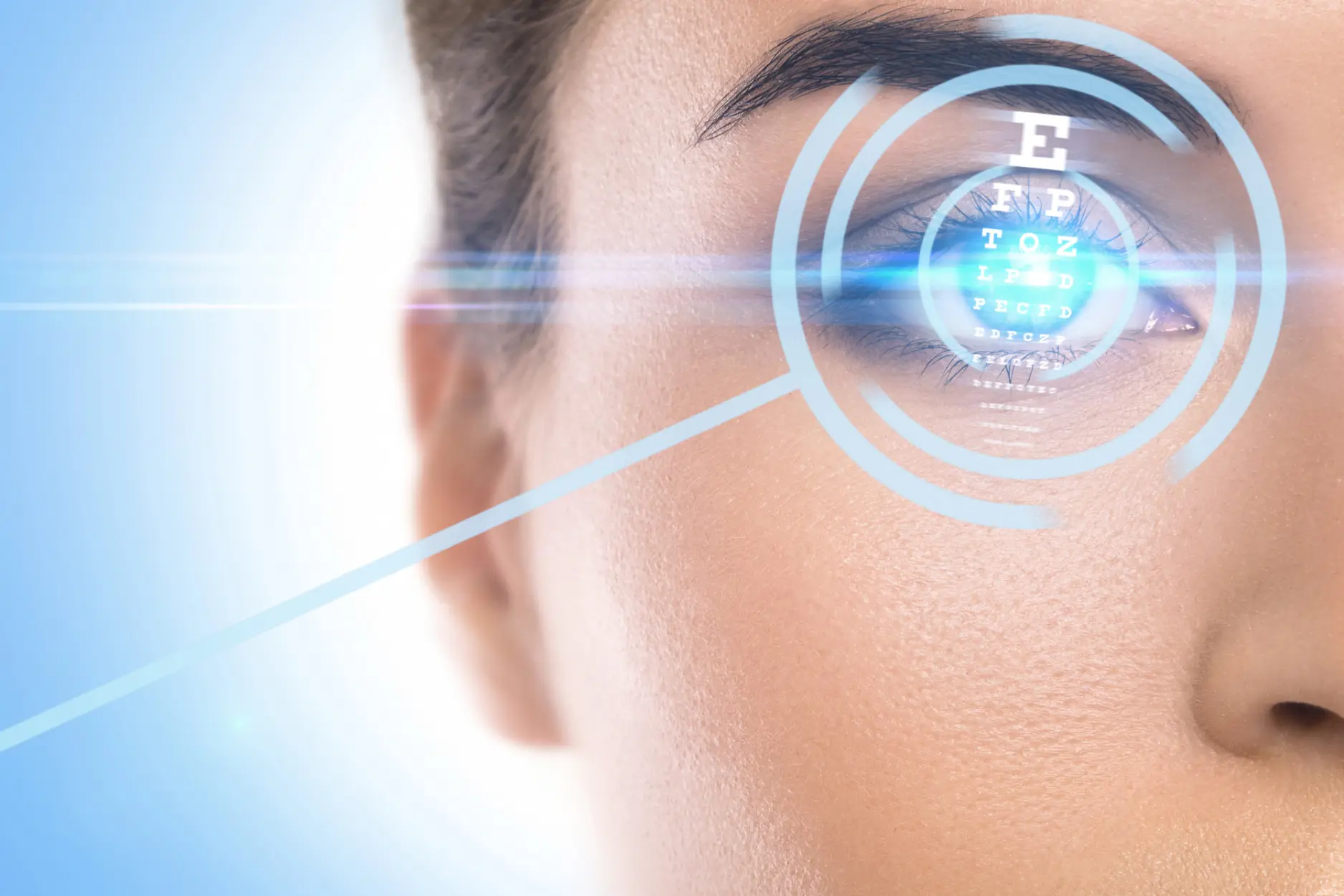 Concepts of laser eye surgery