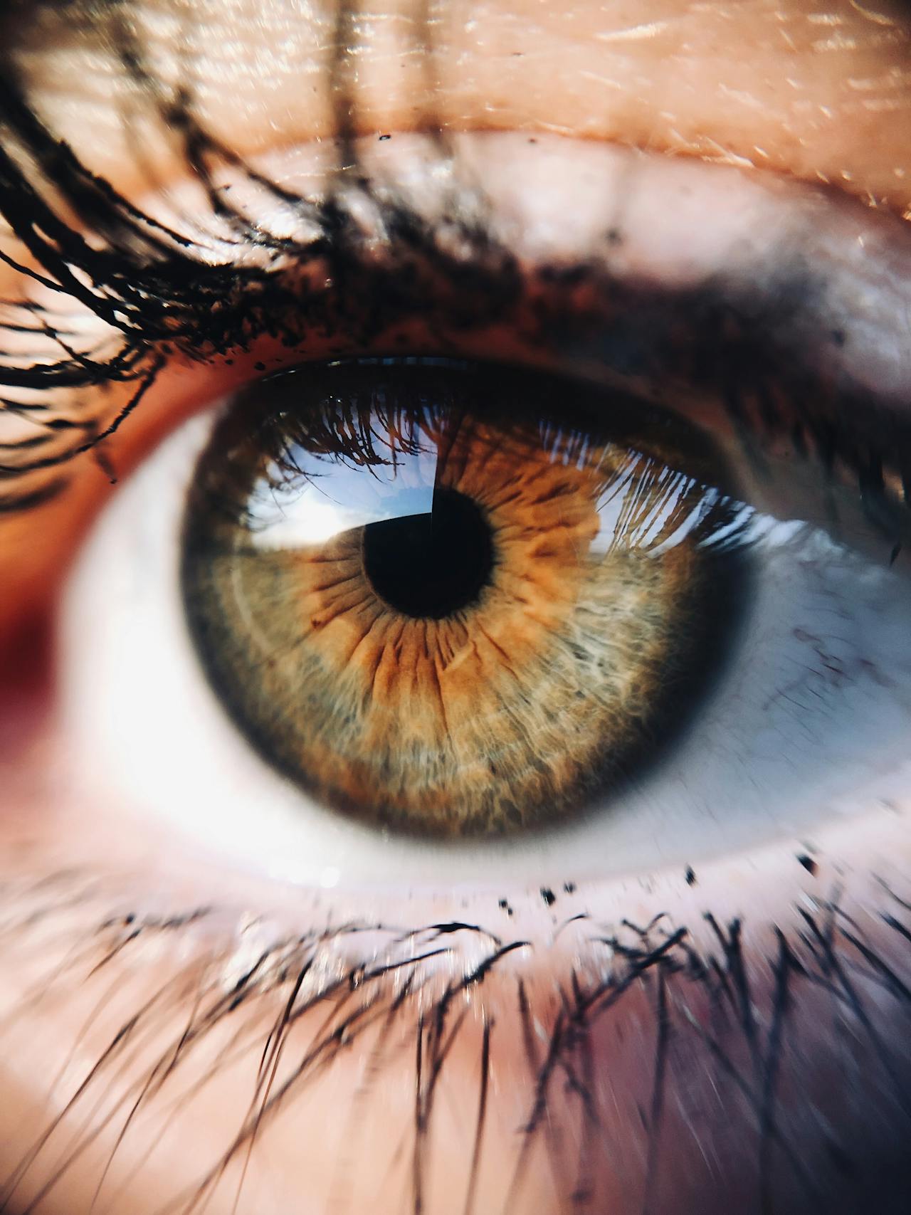 Choosing the Right LASIK Surgeon: Tips for 2024