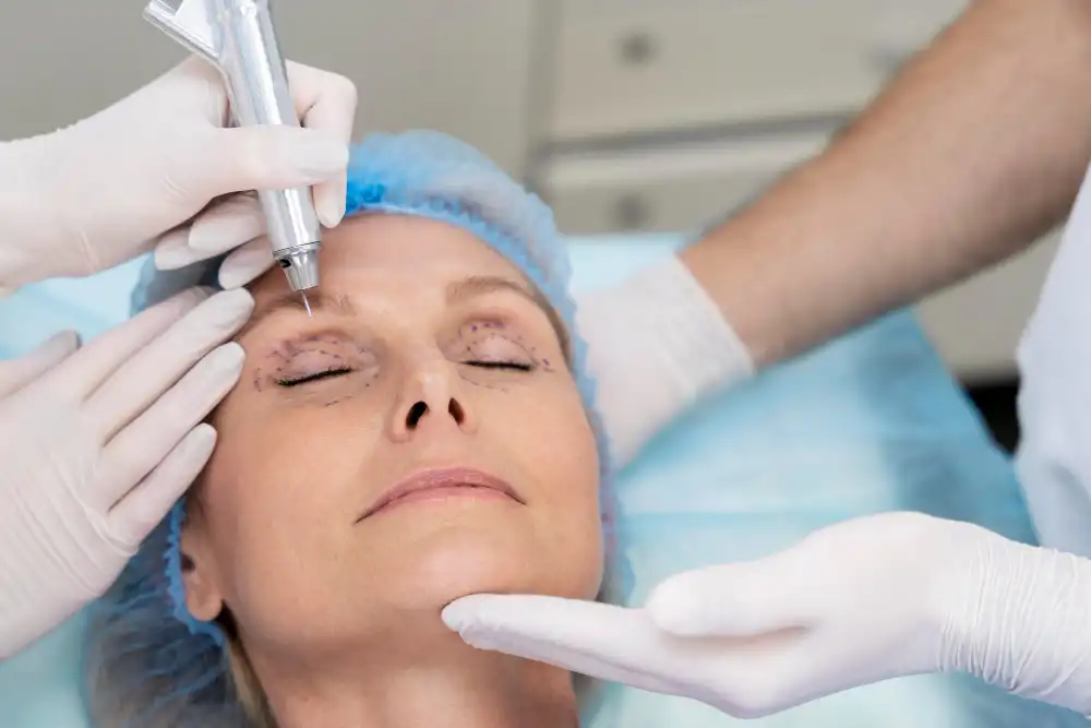 What Happens After the LASIK Eye Surgery